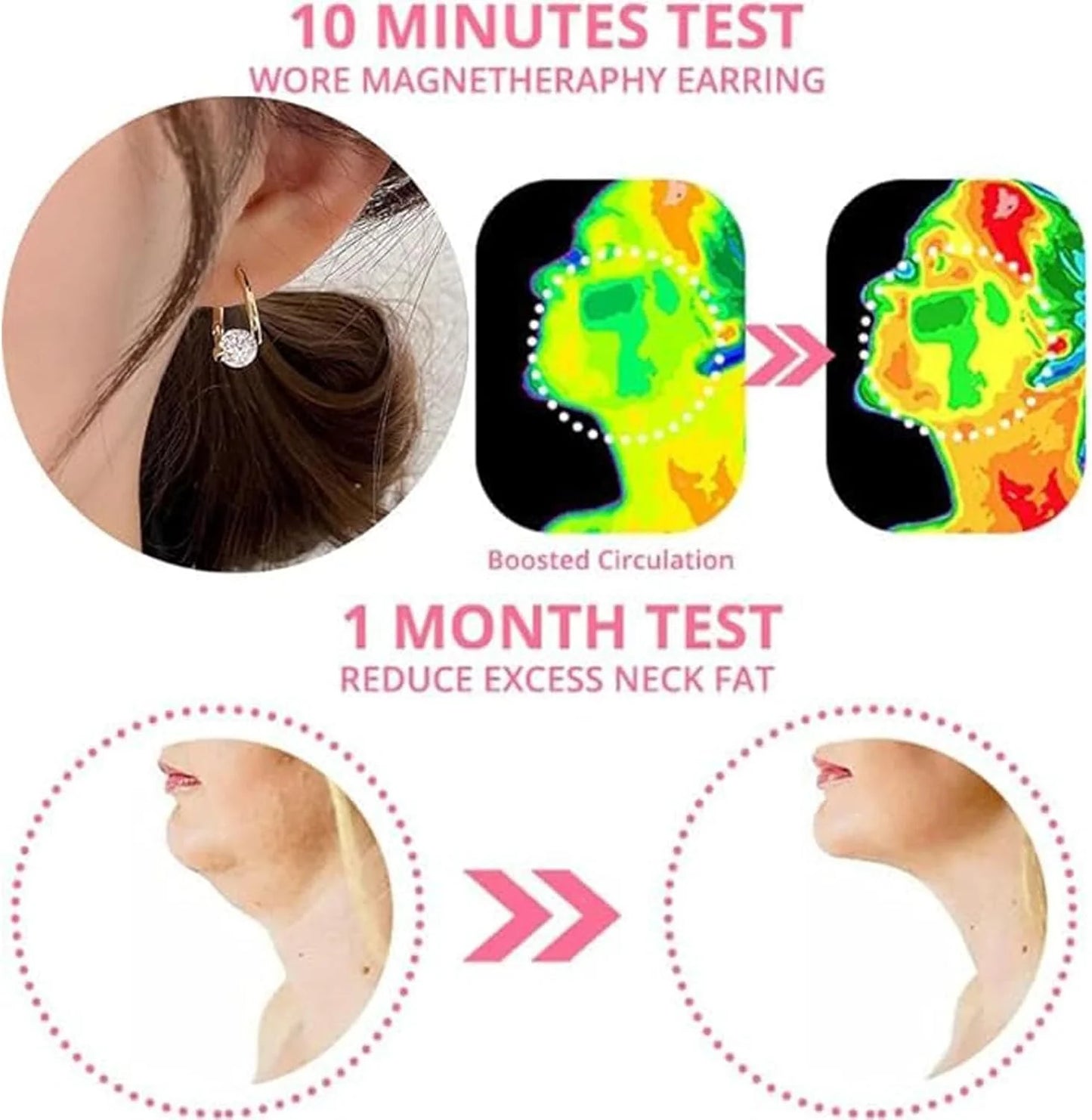 أقراط العلاج المغناطيسي للجهاز اللمفاوي