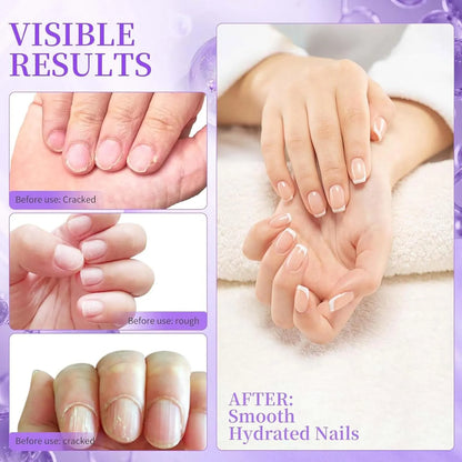 قلم العناية بالأظافر ثلاثي الوظائف – تغذية، حماية، وعطر زهري