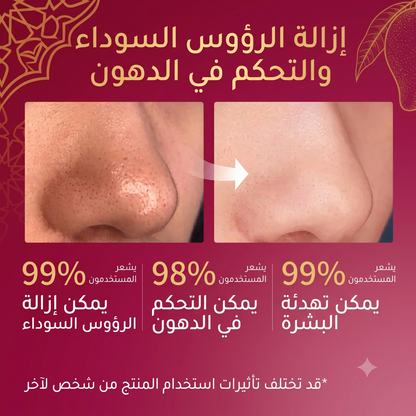 مجموعة RtopR المطورة لتنقية مسام الأنف – مقشر 2 في 1 لإزالة الرؤوس السوداء والدهون مع 50 شريطاً نباتياً
