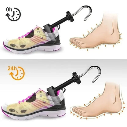 ممدد الأحذية القابل للتعديل