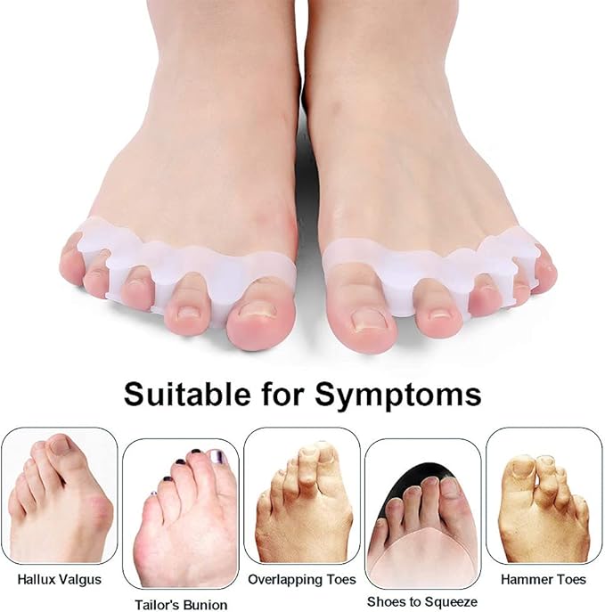 مصحّح أصابع القدم السيليكوني لتخفيف آلام إبهام القدم